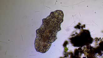 The tardigrade